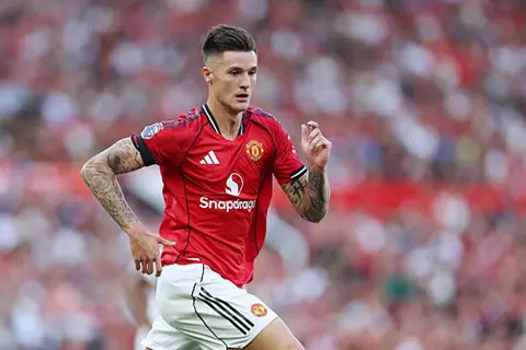 ليس بسبب الإصابة فقط.. تسمم غذائي يؤخر عودة سيسكو إلى مانشستر يونايتد